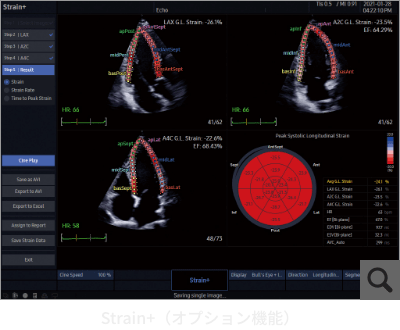 Strain+（オプション機能）