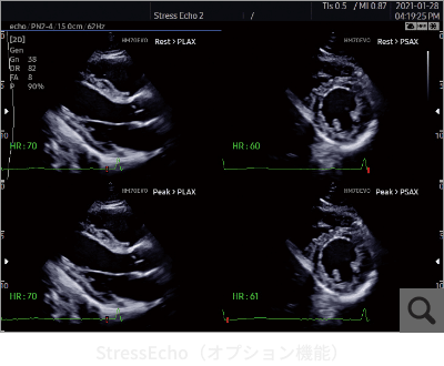 StressEcho（オプション機能）