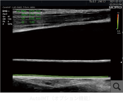 AutoIMT（オプション機能）