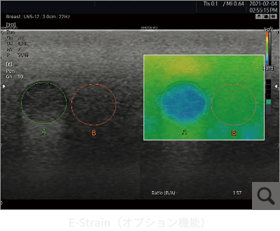 E-Strain（オプション機能）