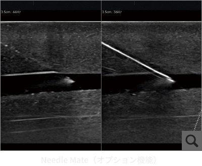 Needle Mate（オプション機能）
