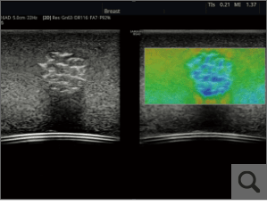 ElastoScan（オプション機能）