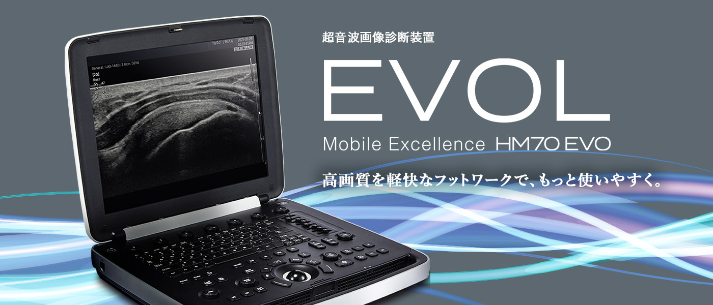 超音波画像診断装置 EVOL Mobile Excellence HM70 EVO 高画質を軽快なフットワークで、もっと使いやすく。